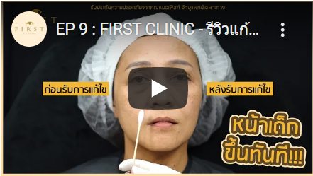 รีวิวทำฟิลเลอร์ตาสองชั้น - First Clinic