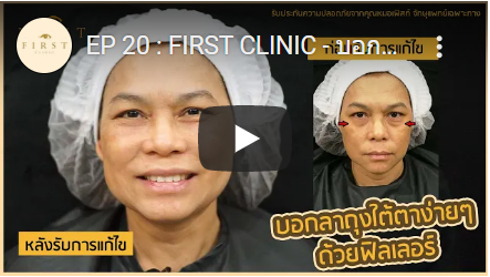 บอกลาถุงใต้ตาง่ายๆ ด้วยฟิลเลอร์ (Filler) - First Clinic