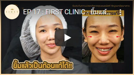 ยิ้มแล้วเป็นก้อนแก้ได้ - First Clinic