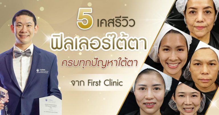 รีวิวใต้ตา