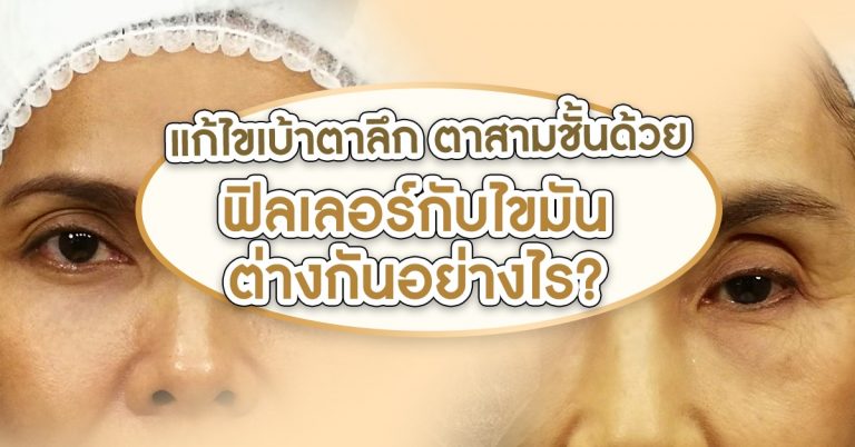 ฟิลเลอร์กับไขมันต่างกันยังไง