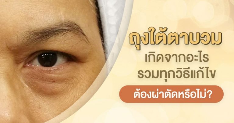 ถุงใต้ตาบวมเกิดจากอะไร